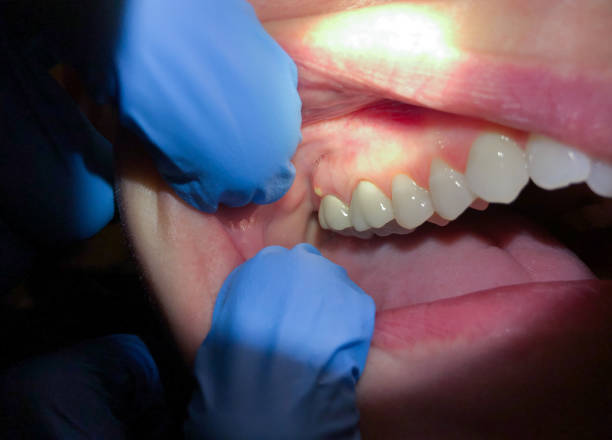 Best Emergency Dental Care for Trauma or Injury in Brownwood, TX